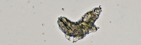 a microscopic image of a tardigrade on a gray background